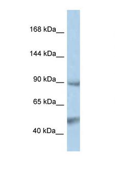 PTPN3 Antibody - PTPN3 antibody Western blot of PANC1 Cell lysate. Antibody concentration 1 ug/ml.  This image was taken for the unconjugated form of this product. Other forms have not been tested.