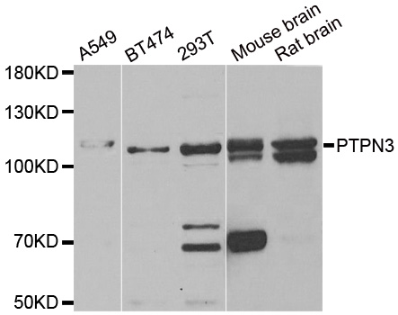 PTPN3 Antibody - Western blot analysis of extracts of various cell lines.