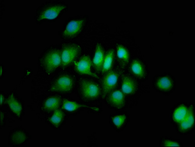 PTPN3 Antibody - Immunofluorescence staining of A549 cells at a dilution of 1:200, counter-stained with DAPI. The cells were fixed in 4% formaldehyde, permeabilized using 0.2% Triton X-100 and blocked in 10% normal Goat Serum. The cells were then incubated with the antibody overnight at 4 °C.The secondary antibody was Alexa Fluor 488-congugated AffiniPure Goat Anti-Rabbit IgG (H+L) .