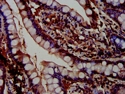 PTPN3 Antibody - Immunohistochemistry image at a dilution of 1:600 and staining in paraffin-embedded human small intestine tissue performed on a Leica BondTM system. After dewaxing and hydration, antigen retrieval was mediated by high pressure in a citrate buffer (pH 6.0) . Section was blocked with 10% normal goat serum 30min at RT. Then primary antibody (1% BSA) was incubated at 4 °C overnight. The primary is detected by a biotinylated secondary antibody and visualized using an HRP conjugated SP system.