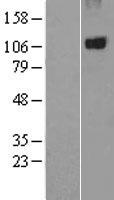 PTPN3 Protein - Western validation with an anti-DDK antibody * L: Control HEK293 lysate R: Over-expression lysate