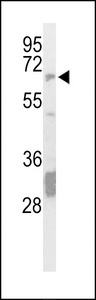 PTPN5 / STEP Antibody - Western blot of hSTEP-Q155 in mouse brain tissue lysates (35 ug/lane). STEP (arrow) was detected using the purified Pab