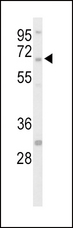 PTPN5 / STEP Antibody - Western blot of hSTEP-Q155 in HepG2 cell line lysates (35 ug/lane). STEP (arrow) was detected using the purified antibody.