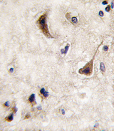 PTPN5 / STEP Antibody - Formalin-fixed and paraffin-embedded human brain tissue reacted with STEP antibody , which was peroxidase-conjugated to the secondary antibody, followed by DAB staining. This data demonstrates the use of this antibody for immunohistochemistry; clinical relevance has not been evaluated.