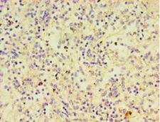 PTPN5 / STEP Antibody - Immunohistochemistry of paraffin-embedded human spleen tissue using antibody at 1:100 dilution.  This image was taken for the unconjugated form of this product. Other forms have not been tested.