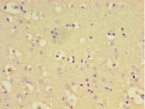 PTPN5 / STEP Antibody - Immunohistochemistry of paraffin-embedded human brain tissue using antibody at 1:100 dilution.  This image was taken for the unconjugated form of this product. Other forms have not been tested.