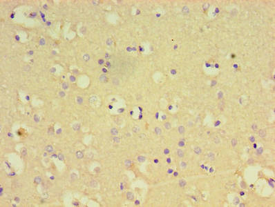 PTPN5 / STEP Antibody - Immunohistochemistry of paraffin-embedded human brain tissue using PTPN5 Antibody at dilution of 1:100