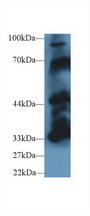 PTPN5 / STEP Antibody - Western Blot; Sample: Mouse Cerebrum lysate; Primary Ab: 1µg/ml Rabbit Anti-Mouse PTPN5 Antibody Second Ab: 0.2µg/mL HRP-Linked Caprine Anti-Rabbit IgG Polyclonal Antibody