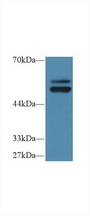 PTPN5 / STEP Antibody - Western Blot; Sample: Human HL60 cell lysate; Primary Ab: 1µg/ml Rabbit Anti-Human PTPN5 Antibody Second Ab: 0.2µg/mL HRP-Linked Caprine Anti-Rabbit IgG Polyclonal Antibody