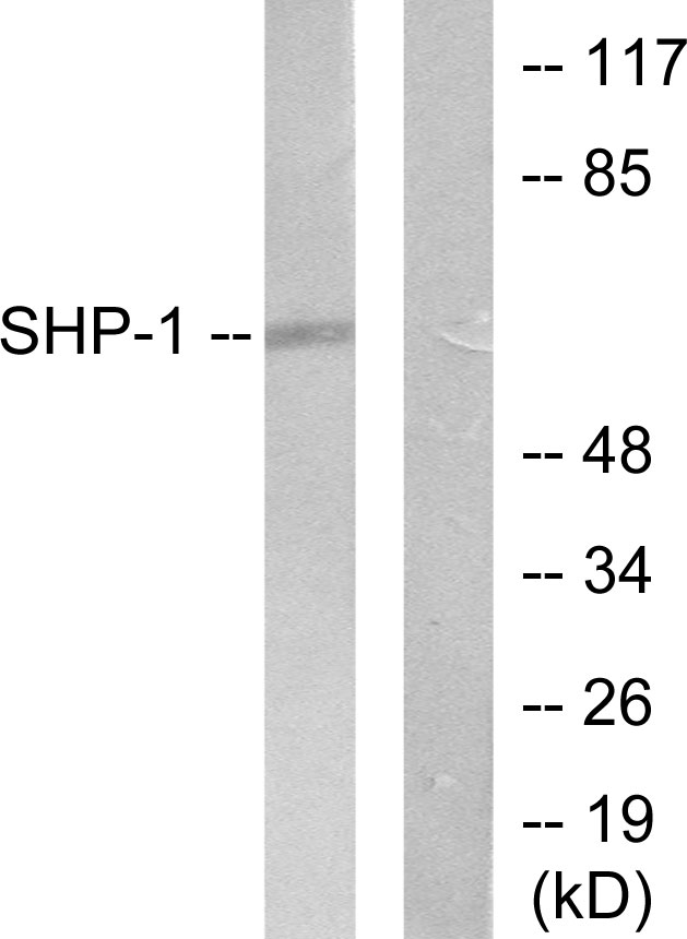 PTPN6 / SHP1 Antibody - Western blot analysis of lysates from NIH/3T3 cells, using SHP-1 Antibody. The lane on the right is blocked with the synthesized peptide.