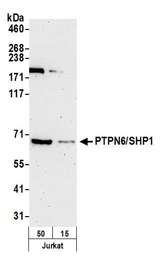 PTPN6 / SHP1 Antibody - Detection of human PTPN6/SHP1 by western blot. Samples: Whole cell lysate (15 and 50 µg) from Jurkat cells prepared using NETN lysis buffer. Antibody: Affinity purified rabbit anti-PTPN6/SHP1 antibody used for WB at 0.1 µg/ml. Detection: Chemiluminescence with an exposure time of 3 minutes.