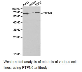 PTPN6 / SHP1 Antibody - Western blot.