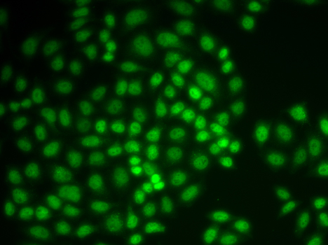 PTPN6 / SHP1 Antibody - Immunofluorescence analysis of MCF-7 cells.