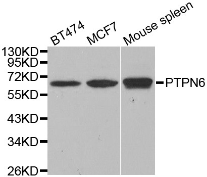 PTPN6 / SHP1 Antibody - Western blot analysis of extracts of various cell lines, using PTPN6 antibody at 1:1000 dilution. The secondary antibody used was an HRP Goat Anti-Rabbit IgG (H+L) at 1:10000 dilution. Lysates were loaded 25ug per lane and 3% nonfat dry milk in TBST was used for blocking.
