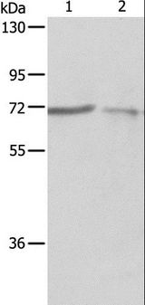 PTPN6 / SHP1 Antibody - Western blot analysis of A375 and A431 cell, using PTPN6 Polyclonal Antibody at dilution of 1:500.