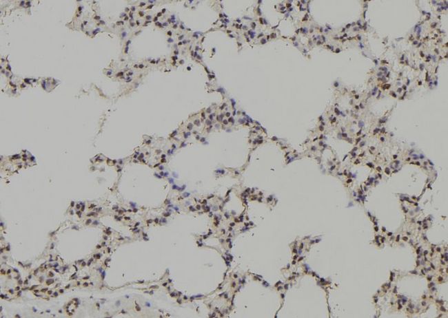 PTPN6 / SHP1 Antibody - 1:100 staining rat lung tissue by IHC-P. The sample was formaldehyde fixed and a heat mediated antigen retrieval step in citrate buffer was performed. The sample was then blocked and incubated with the antibody for 1.5 hours at 22°C. An HRP conjugated goat anti-rabbit antibody was used as the secondary.
