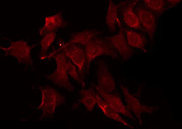 PTPN6 / SHP1 Antibody - Staining RAW264.7 cells by IF/ICC. The samples were fixed with PFA and permeabilized in 0.1% Triton X-100, then blocked in 10% serum for 45 min at 25°C. The primary antibody was diluted at 1:200 and incubated with the sample for 1 hour at 37°C. An Alexa Fluor 594 conjugated goat anti-rabbit IgG (H+L) Ab, diluted at 1/600, was used as the secondary antibody.