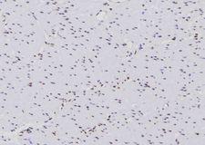 PTPN6 / SHP1 Antibody - 1:100 staining human gastric tissue by IHC-P. The sample was formaldehyde fixed and a heat mediated antigen retrieval step in citrate buffer was performed. The sample was then blocked and incubated with the antibody for 1.5 hours at 22°C. An HRP conjugated goat anti-rabbit antibody was used as the secondary.