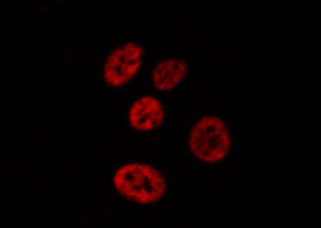 PTPN6 / SHP1 Antibody - Staining RAW264.7 cells by IF/ICC. The samples were fixed with PFA and permeabilized in 0.1% Triton X-100, then blocked in 10% serum for 45 min at 25°C. The primary antibody was diluted at 1:200 and incubated with the sample for 1 hour at 37°C. An Alexa Fluor 594 conjugated goat anti-rabbit IgG (H+L) antibody, diluted at 1/600, was used as secondary antibody.