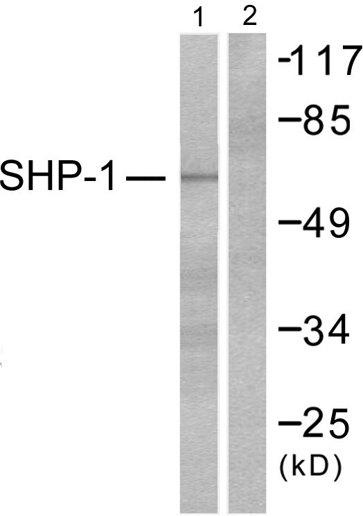 PTPN6 / SHP1 Antibody - Western blot analysis of extracts from NIH/3T3 cells, using SHP-1 (Ab-536) antibody ( Line 1 and 2).