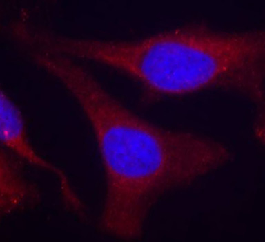 PTPN6 / SHP1 Antibody - Immunofluorescence staining of methanol-fixed Hela cells.