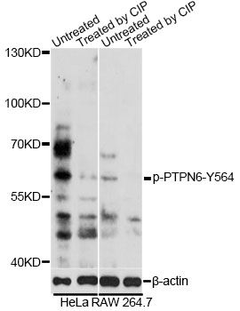 PTPN6 / SHP1 Antibody - Western blot analysis of extracts of HeLa and RAW 264.7 cells, using Phospho-PTPN6-Y564 antibody at 1:2000 dilution. HeLa cell lysates were treated by CIP at 37Â°C for 1 hour.RAW 264.7 cell lysates were treated by CIP at 37Â°C for 1 hour. The secondary antibody used was an HRP Goat Anti-Rabbit IgG (H+L) at 1:10000 dilution. Lysates were loaded 25ug per lane and 3% nonfat dry milk in TBST was used for blocking. Blocking buffer: 3% BSA.An ECL Kit was used for detection and the exposure time was 3min.