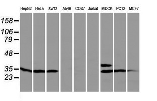 PTPN7 / HEPTP Antibody - Western blot of extracts (35 ug) from 9 different cell lines by using anti-PTPN7 monoclonal antibody.