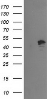 PTPN7 / HEPTP Antibody - HEK293T cells were transfected with the pCMV6-ENTRY control (Left lane) or pCMV6-ENTRY PTPN7 (Right lane) cDNA for 48 hrs and lysed. Equivalent amounts of cell lysates (5 ug per lane) were separated by SDS-PAGE and immunoblotted with anti-PTPN7.
