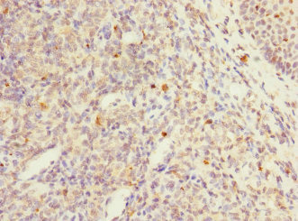 PTPN7 / HEPTP Antibody - Immunohistochemistry of paraffin-embedded human tonsil tissue at dilution 1:100