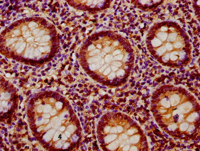 PTPN9 / MEG2 Antibody - Immunohistochemistry Dilution at 1:400 and staining in paraffin-embedded human appendix tissue performed on a Leica BondTM system. After dewaxing and hydration, antigen retrieval was mediated by high pressure in a citrate buffer (pH 6.0). Section was blocked with 10% normal Goat serum 30min at RT. Then primary antibody (1% BSA) was incubated at 4°C overnight. The primary is detected by a biotinylated Secondary antibody and visualized using an HRP conjugated SP system.
