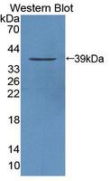 PTPN9 / MEG2 Antibody - Western Blot; Sample: Recombinant protein.