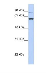 PTPRA / RPTP-Alpha Antibody - 293T cell lysate. Antibody concentration: 1.0 ug/ml. Gel concentration: 12%.  This image was taken for the unconjugated form of this product. Other forms have not been tested.