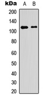 PTPRA / RPTP-Alpha Antibody - Western blot analysis of PTP alpha (pY798) expression in HT29 (A); NIH3T3 (B) whole cell lysates.