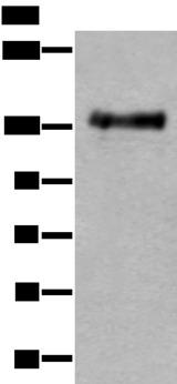 PTPRA / RPTP-Alpha Antibody - Western blot analysis of Mouse brain tissue lysate  using PTPRA Polyclonal Antibody at dilution of 1:400