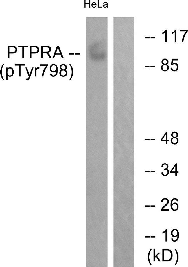 PTPRA / RPTP-Alpha Antibody - Western blot analysis of extracts from HeLa cells, treated with serum (20%, 15mins), using PTPRA (Phospho-Tyr798) antibody.