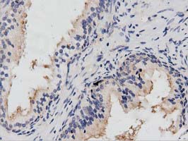 PTPRE / PTP Epsilon Antibody - IHC of paraffin-embedded Human prostate tissue using anti-PTPRE mouse monoclonal antibody. (Dilution 1:50).