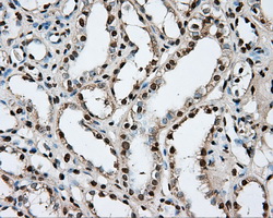 PTPRE / PTP Epsilon Antibody - IHC of paraffin-embedded Kidney tissue using anti-PTPRE mouse monoclonal antibody. (Dilution 1:50).