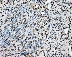 PTPRE / PTP Epsilon Antibody - IHC of paraffin-embedded endometrium tissue using anti-PTPRE mouse monoclonal antibody. (Dilution 1:50).