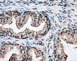 PTPRE / PTP Epsilon Antibody - IHC of paraffin-embedded prostate tissue using anti-PTPRE mouse monoclonal antibody. (Dilution 1:50).
