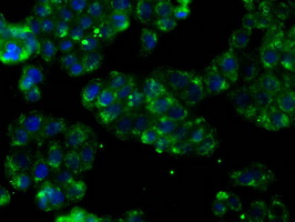 PTPRE / PTP Epsilon Antibody - Immunofluorescent staining of HT29 cells using anti-PTPRE mouse monoclonal antibody.