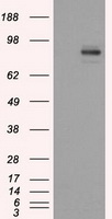 PTPRE / PTP Epsilon Antibody - HEK293T cells were transfected with the pCMV6-ENTRY control (Left lane) or pCMV6-ENTRY PTPRE (Right lane) cDNA for 48 hrs and lysed. Equivalent amounts of cell lysates (5 ug per lane) were separated by SDS-PAGE and immunoblotted with anti-PTPRE.