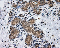 PTPRE / PTP Epsilon Antibody - IHC of paraffin-embedded breast tissue using anti-PTPRE mouse monoclonal antibody. (Dilution 1:50).