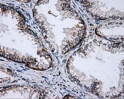 PTPRE / PTP Epsilon Antibody - IHC of paraffin-embedded prostate tissue using anti-PTPRE mouse monoclonal antibody. (Dilution 1:50).