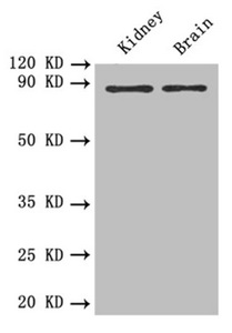 PTPRE / PTP Epsilon Antibody - Western blot All Lanes: PTPRE antibody at 0.6 ug/ml Lane 1: Mouse kidney tissue Lane 2: Mouse brain tissue Secondary Goat polyclonal to rabbit IgG at 1/10000 dilution Predicted band size: 81,75,72 kDa Observed band size: 80 kDa