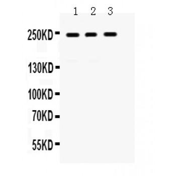 PTPRF Antibody - LAR antibody Western blot. All lanes: Anti LAR at 0.5 ug/ml. Lane 1: HELA Whole Cell Lysate at 40 ug. Lane 2: A431 Whole Cell Lysate at 40 ug. Lane 3: A549 Whole Cell Lysate at 40 ug. Predicted band size: 240 kD. Observed band size: 240 kD.