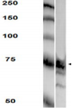 PTPRF Antibody - Detection of PTPRF in rat brain lysate with PTPRF Monoclonal Antibody at 4ug/ml.