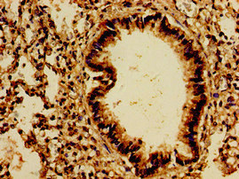 PTPRF Antibody - Immunohistochemistry image of paraffin-embedded human lung tissue at a dilution of 1:100