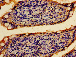 PTPRF Antibody - Immunohistochemistry image of paraffin-embedded human small intestine tissue at a dilution of 1:100