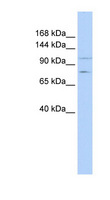 PTPRH / SAP-1 Antibody - PTPRH antibody Western blot of MCF7 cell lysate. This image was taken for the unconjugated form of this product. Other forms have not been tested.