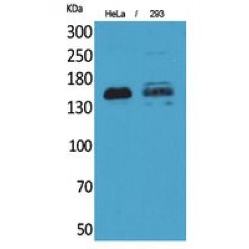 PTPRJ / CD148 Antibody - Western blot of CD148 antibody